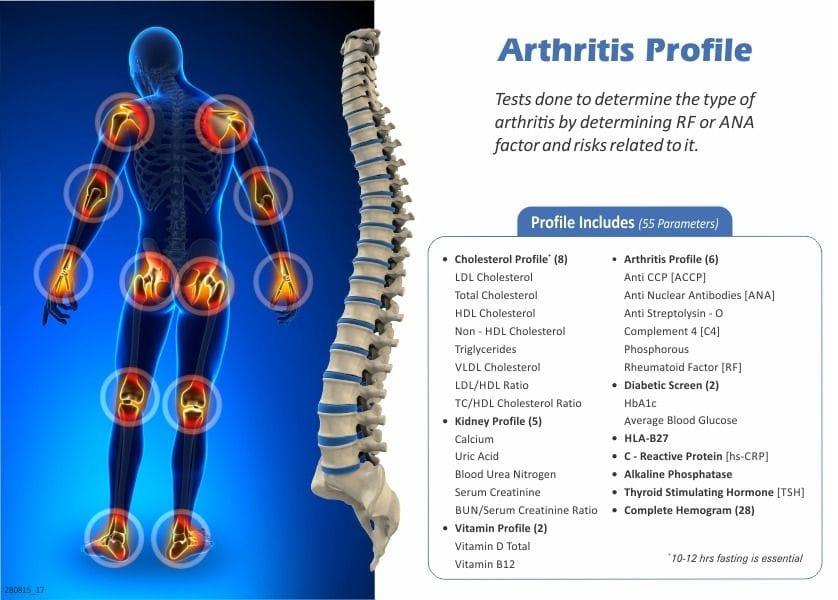 Arthritis profile